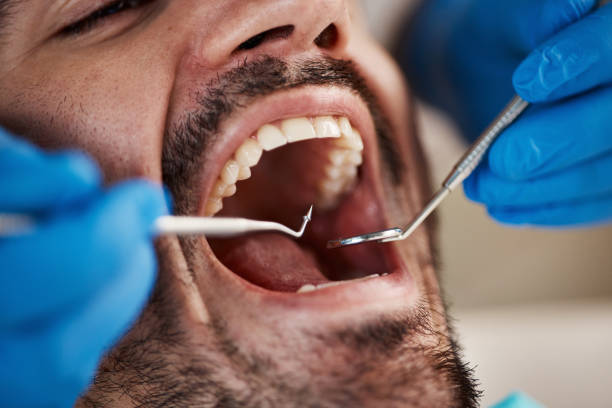 Best Emergency Broken Tooth Repair in Lone Star, TX